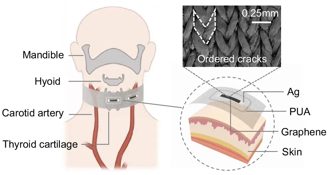 Schematic of a textile-based strain-sensing choker. Two channels are aligned with the carotid artery and center of throat, respectively. Each channel consists of a two-terminal crack-based resistive strain sensor surrounded by a polyurethane acrylate (PUA) stress isolation layer.