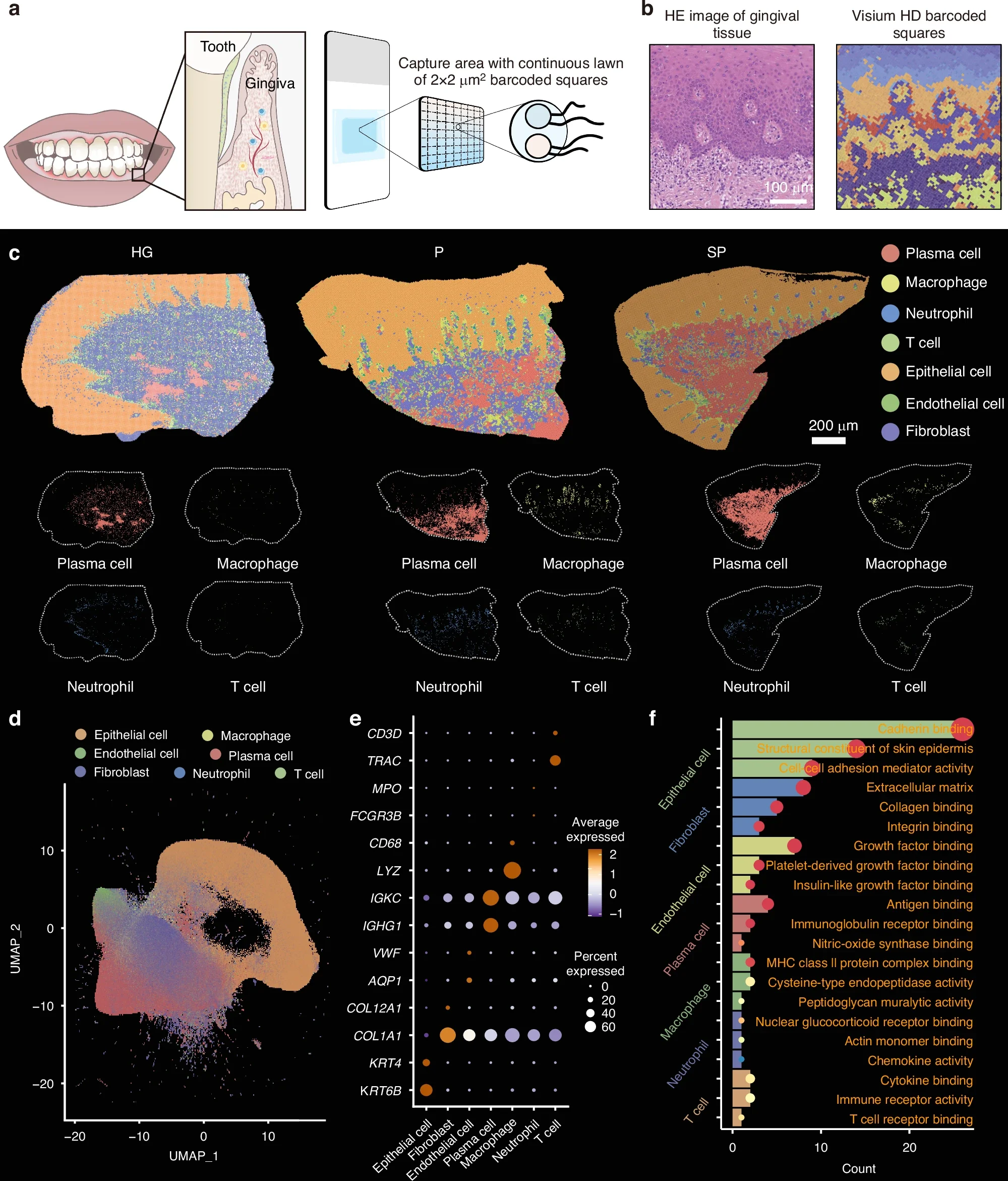 Construction of a single-cell resolution spatial transcriptomic atlas of human gingivae.