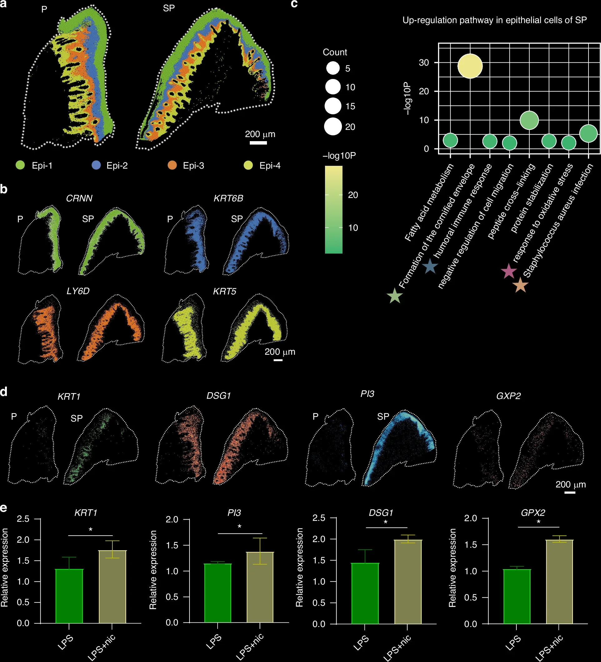 Smoking-induced damage in gingival epithelial cells.