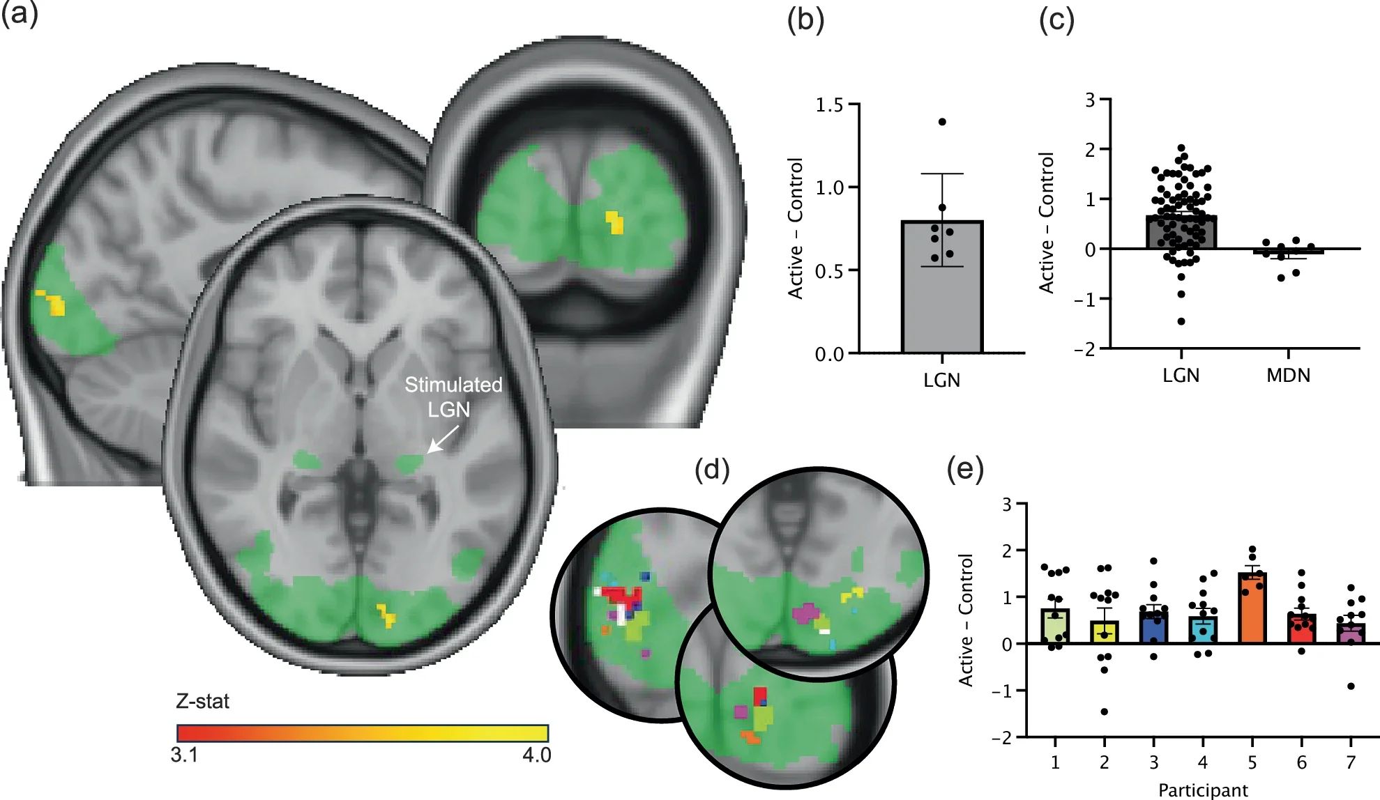 Ultrasound stimulation to the left LGN during a visual task leads to significantly increased activity in the ipsilateral occipital cortex compared with sham.