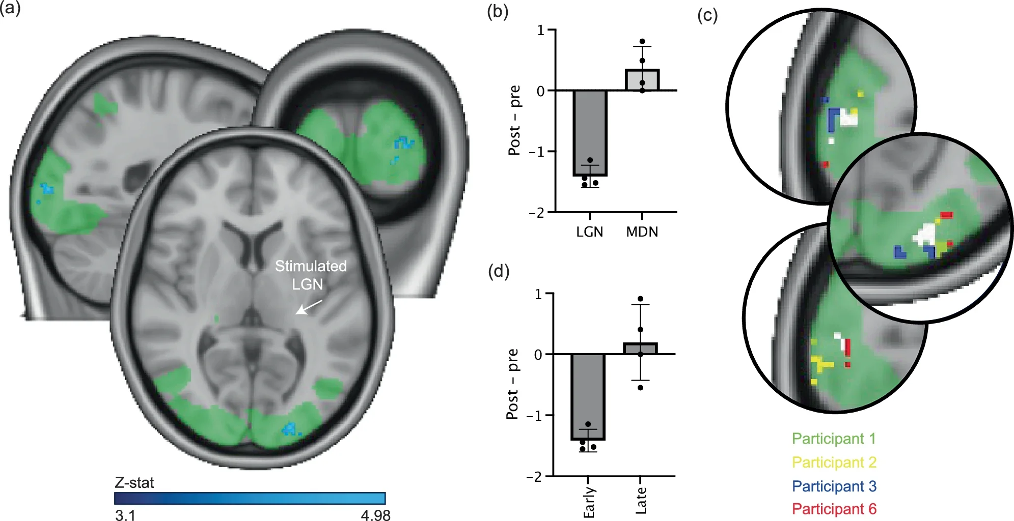 Offline ultrasound stimulation to the left LGN significantly decreases task-related activity in the ipsilateral visual cortex during a visual checkerboard task, early after stimulation.