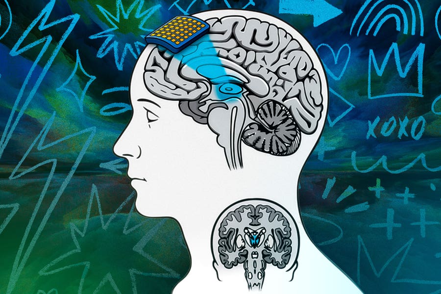 New research outlines how focused ultrasound could reveal which brain regions cause conscious perception in healthy humans.