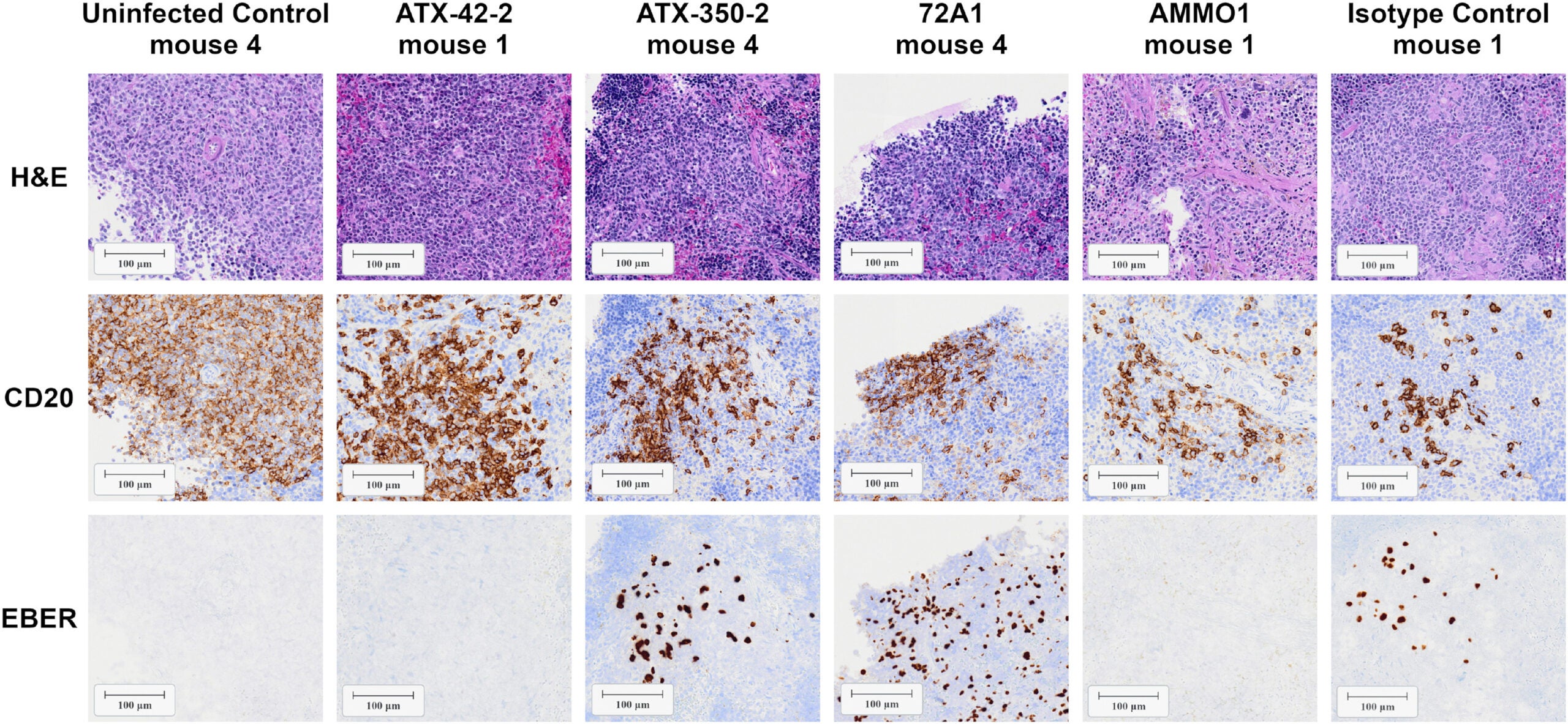 Splenic sections from representative mice from experiment 1 were stained for hematoxylin and eosin (H&E), human CD20, and EBER1 transcripts at necropsy as indicated.