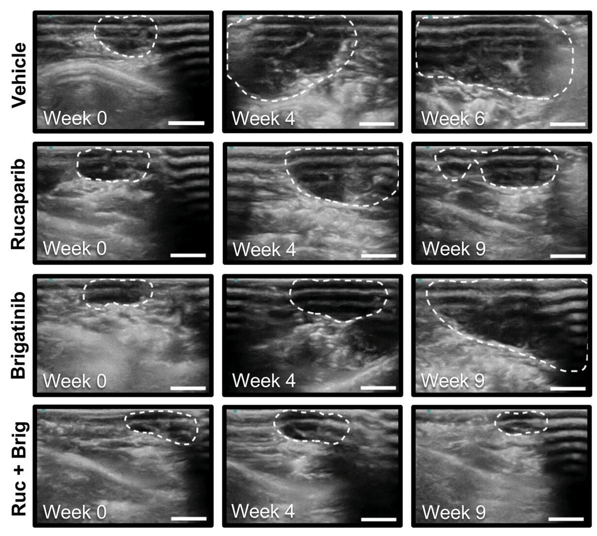 Representative ultrasound images of intraperitoneal tumors in PH747 mice [shown in (A)] at the indicated time points and treatments. White dashed lines outline tumor area.