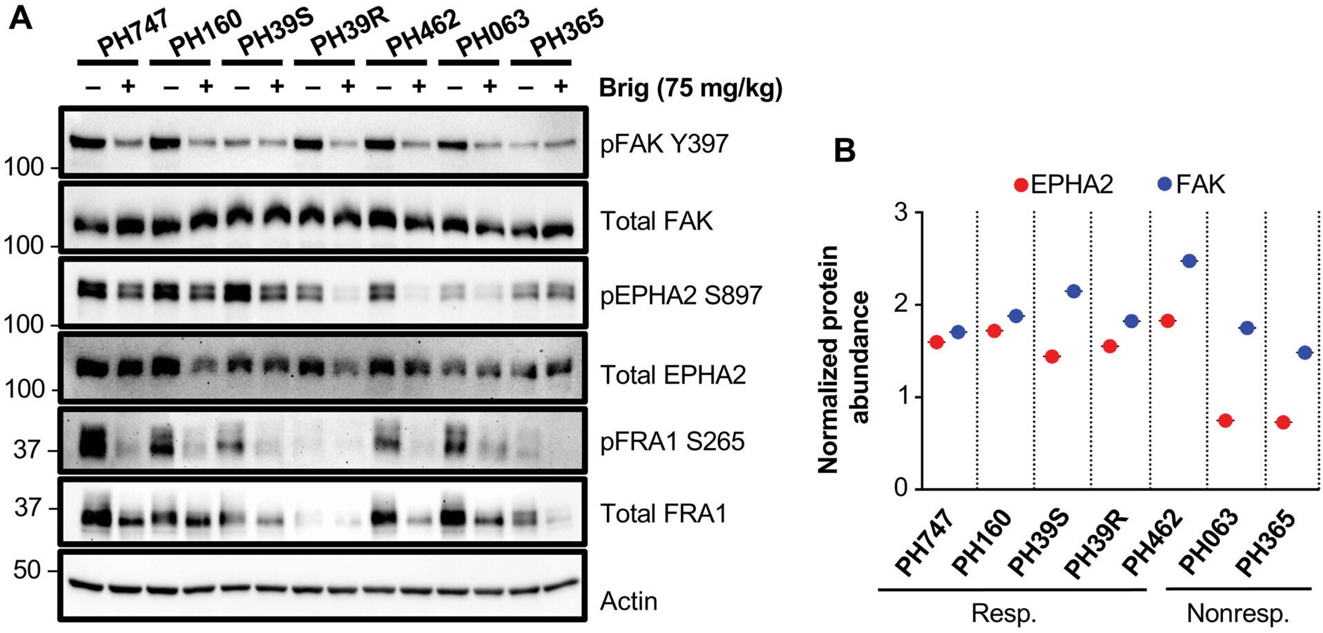 Co-overexpression of FAK and EPHA2 correlates with responses to the brigatinib and PARPi combination in HGSOC models and with poor patient survival.