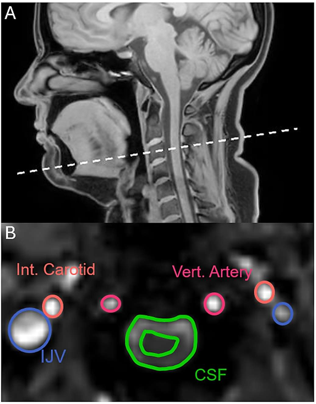 Imaging planes and analysis regions of interest.