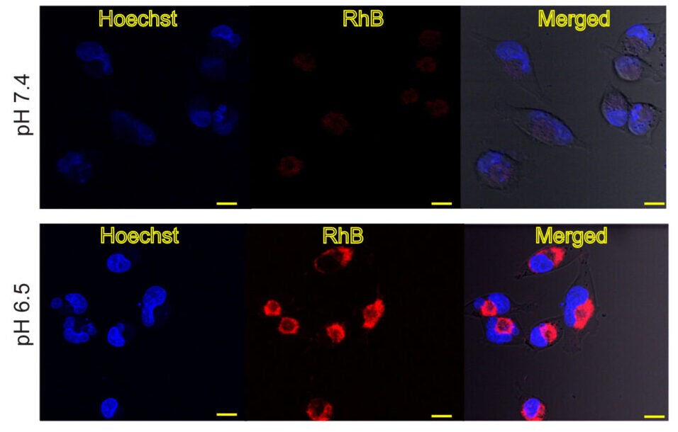 Confocal fluorescence microscopy images of MIA PaCa-2 cells incubated with rhodamine B (RhB)-loaded ALHAPNs