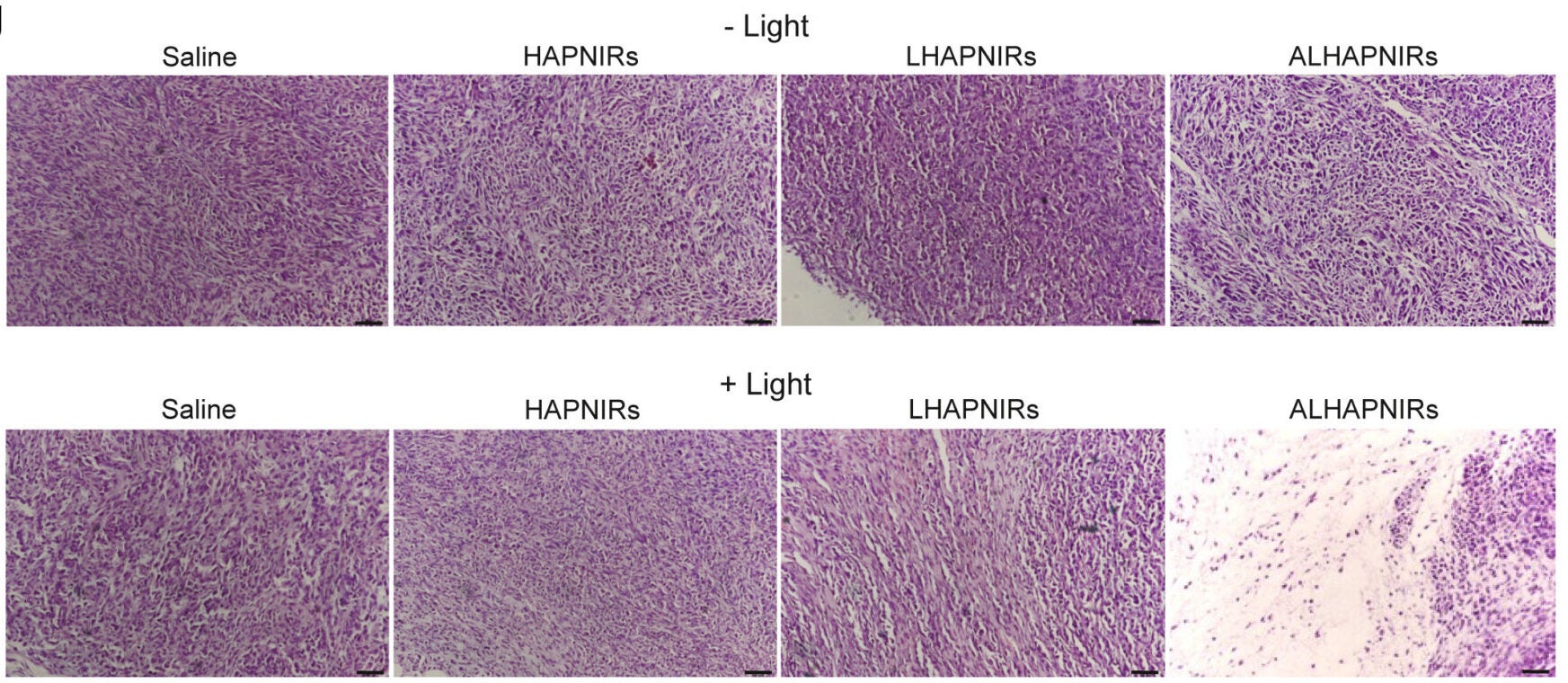 H&E staining of tumor sections from the different groups after the 30 days of treatment in the absence (top) or presence (lower) of NIR-II light irradiation.