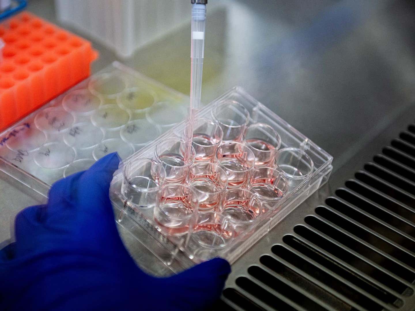 The Penn State research team used advanced super‑resolution microscopy, a type of imaging technique that can peer into cells at the nanoscale — about 10,000 times smaller than the thickness of a human hair — to study neurons grown in petri dishes in the lab.