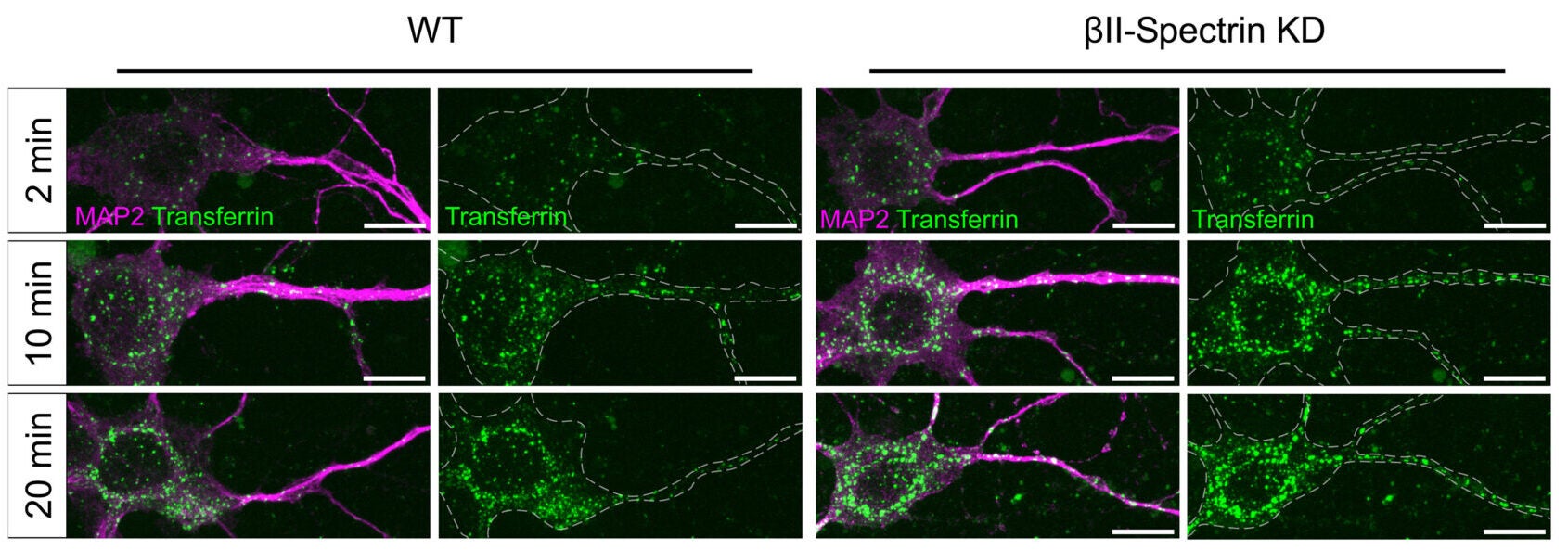 MPS inhibits ligand-induced endocytosis in both axonal and somatodendritic compartments.