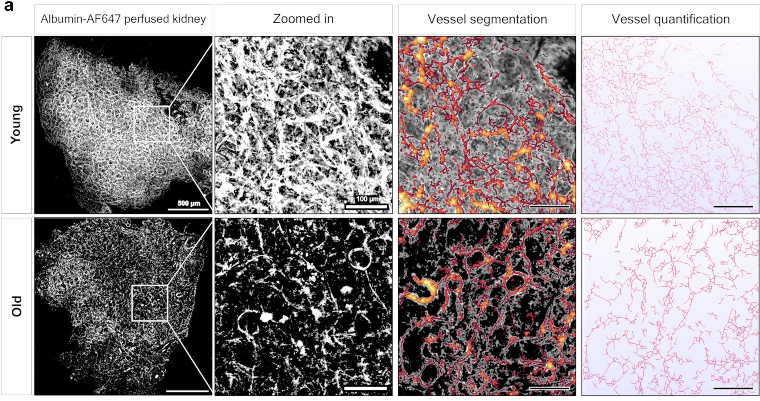 Age-associated changes in vascular morphology and density in the killifish kidney.