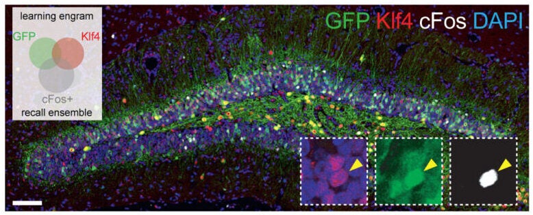 Immunofluorescence picture with magnifications and quantification for reactivation (c-Fos+) in OSK-injected aged mice of non-reprogrammed (GFP+Klf4−) vs. reprogrammed (GFP−Klf4+ and GFP+Klf4+, yellow arrowhead) DG engrams.