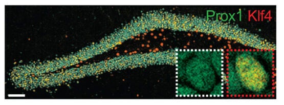 Immunofluorescence picture with magnifications (top; representative Klf4− and Klf4+ in white and red insets, respectively) and quantifications (bottom) of cell identity.