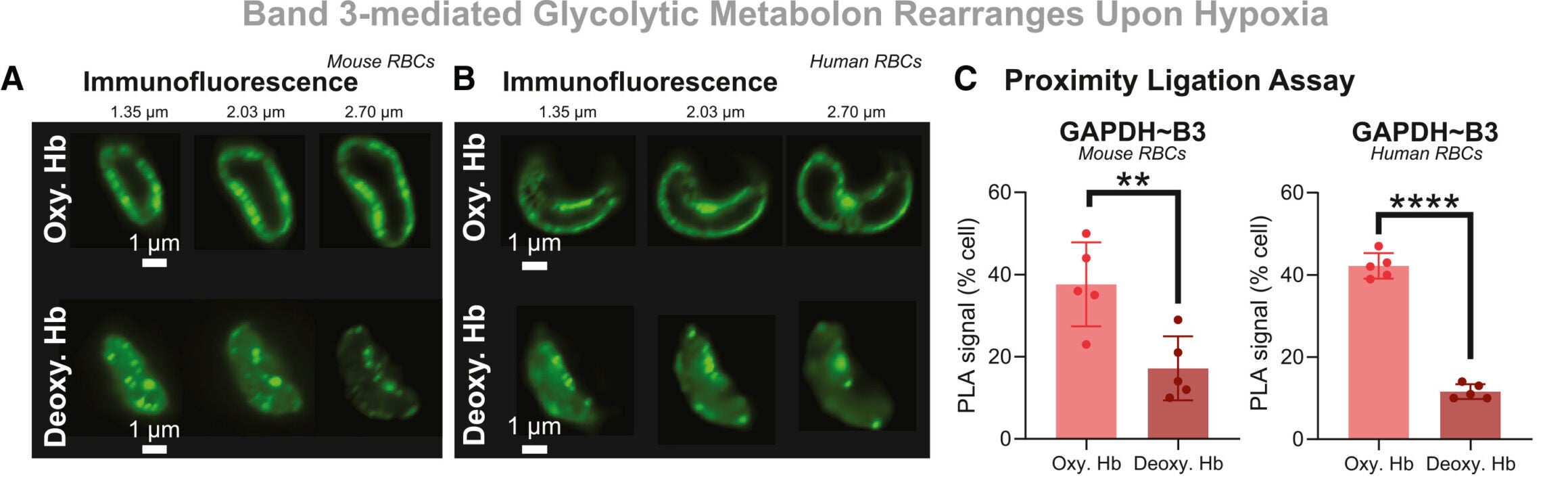 Oxygen-dependent rearrangement of band 3 glycolytic metabolon to explain the shift in glycolytic flux