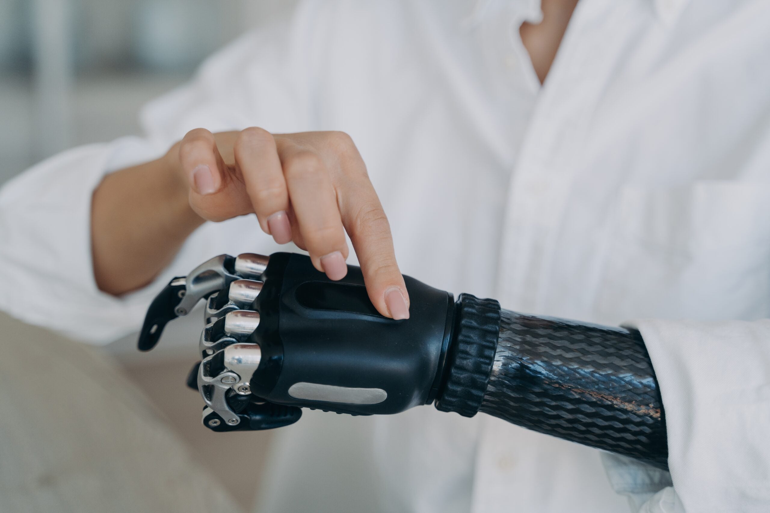 thebrighterside.news - Joseph Shavit - Prosthetic arm blurs the line between machine and human body