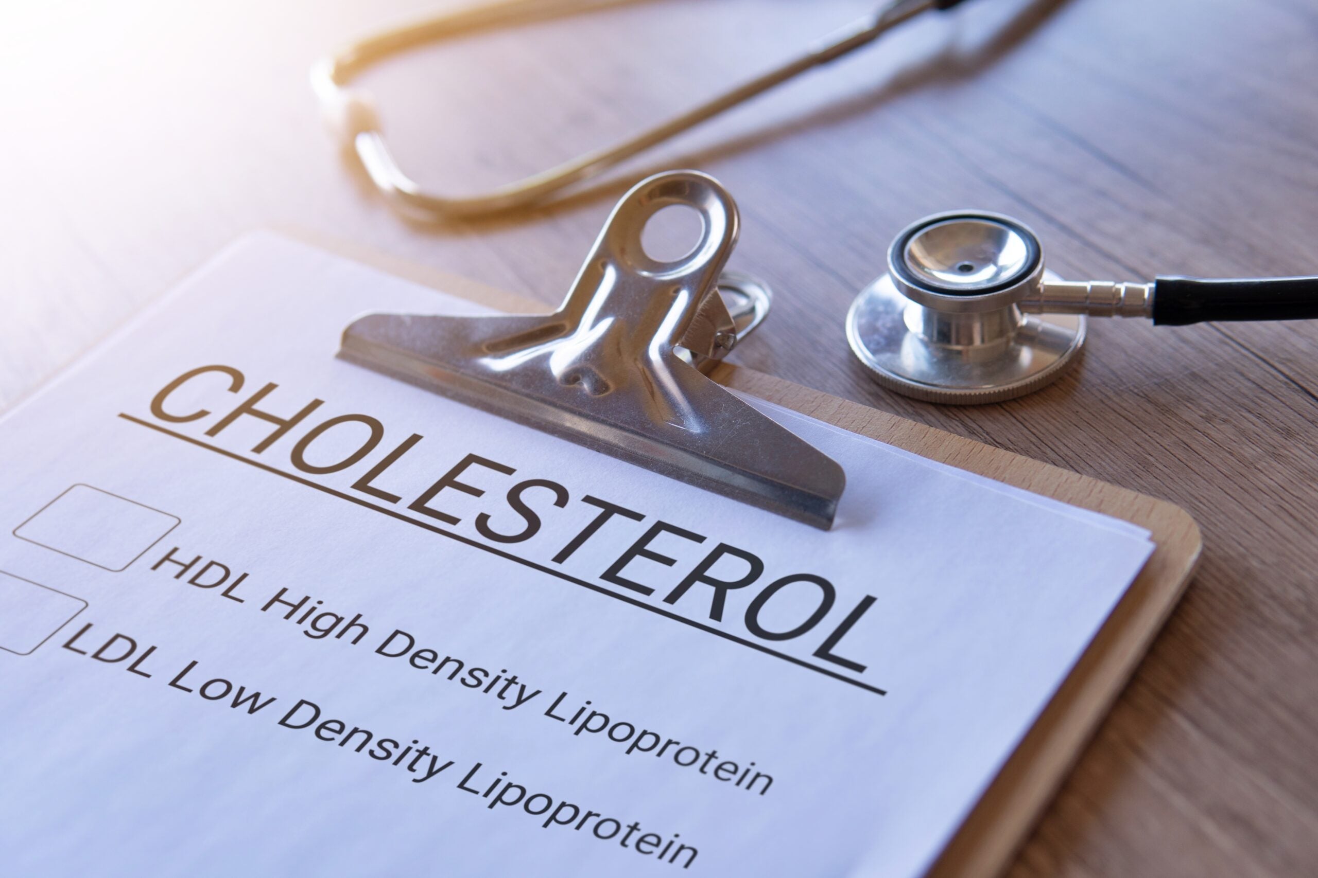 High levels of LDL cholesterol has been identified as one of the biggest contributors to the formation of plaque in the arteries.