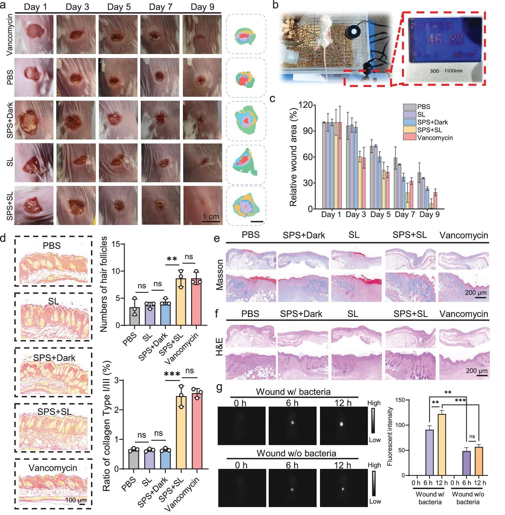 Wound healing effects on different treatment methods.