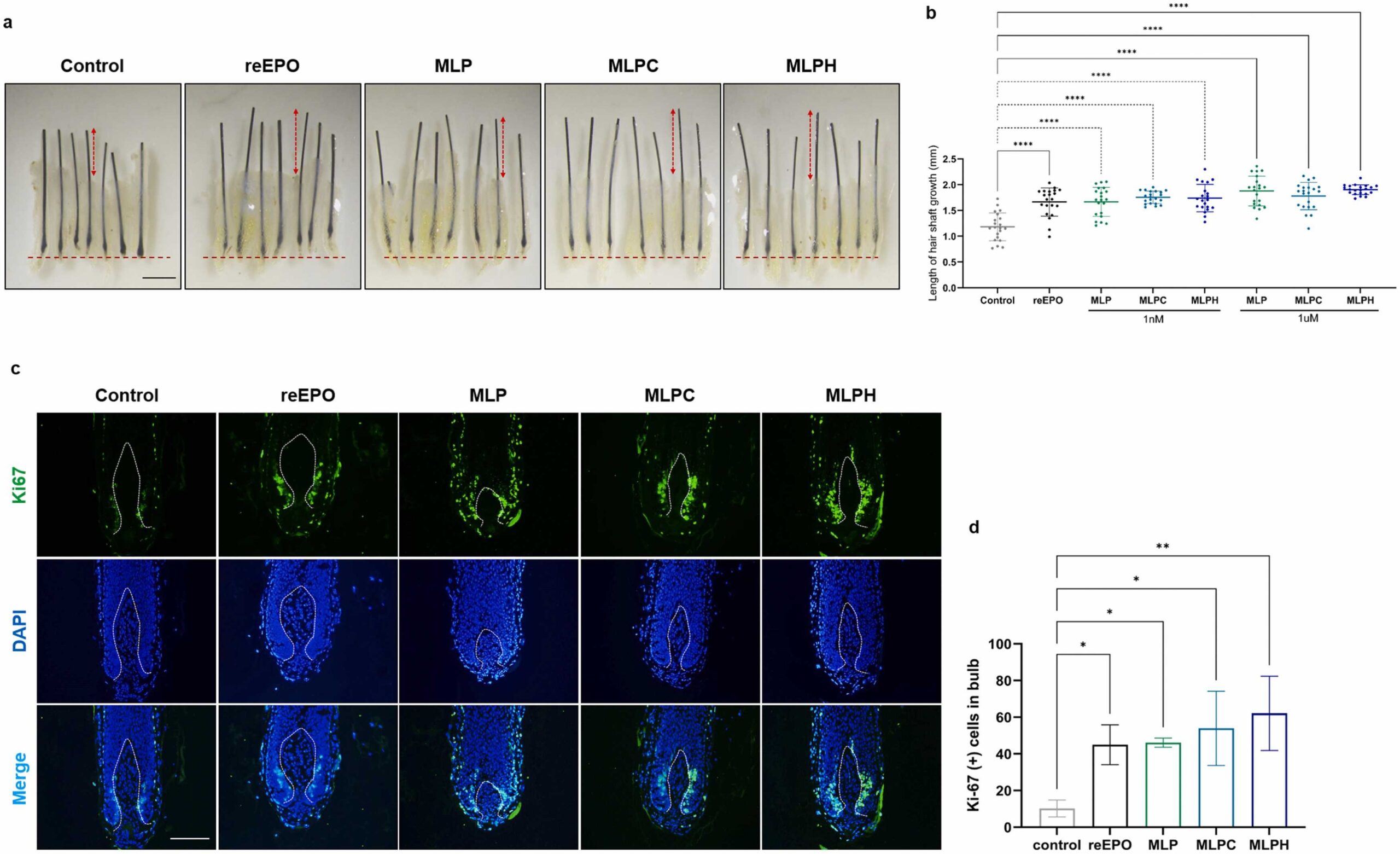 MLP, MLPC and MLPH enhance hair shaft elongation and proliferation in ex vivo human hair follicle cultures.
