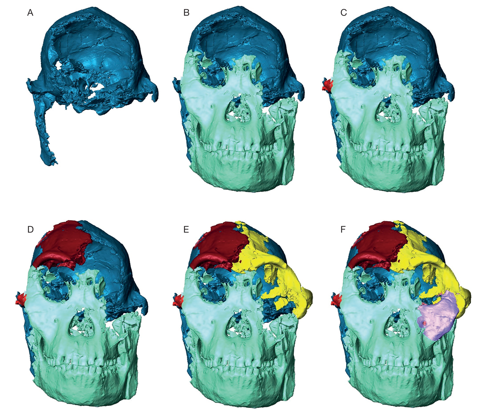 Reconstruction of the face of StW 573. The braincase and right ramus in blue (A) are aligned with the maxilla and the rest of the mandible in green (B).