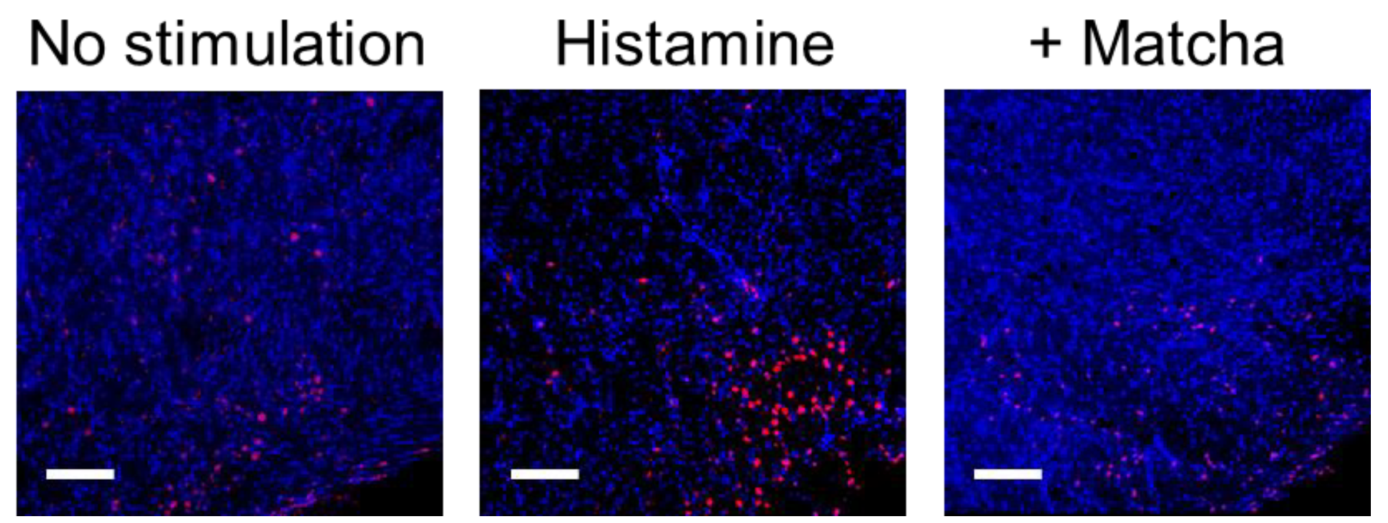 Effect of Matcha extract on histamine- and substance P-induced sneezing reaction.