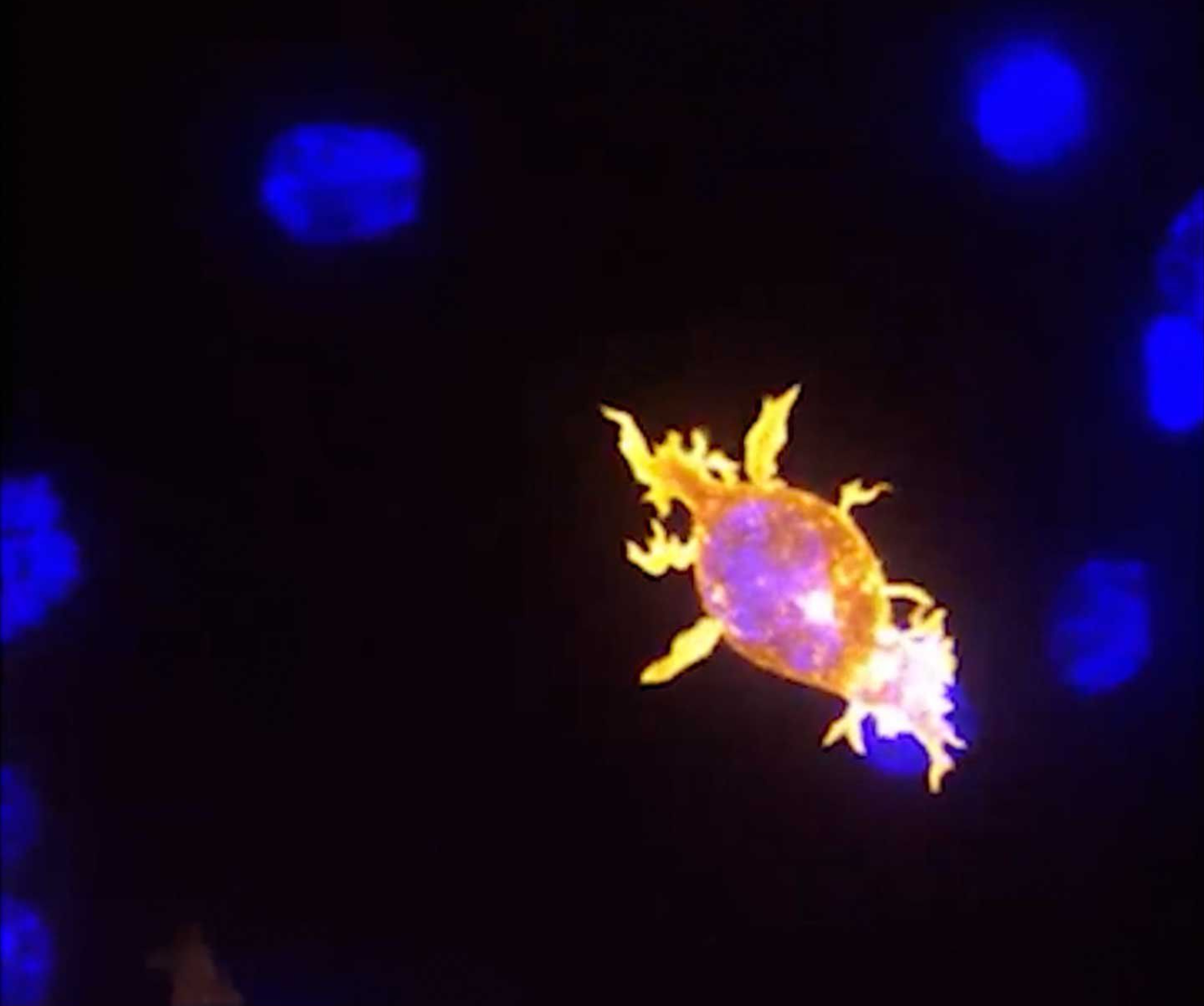 Killer T cell (orange) attacking cancer (blue).