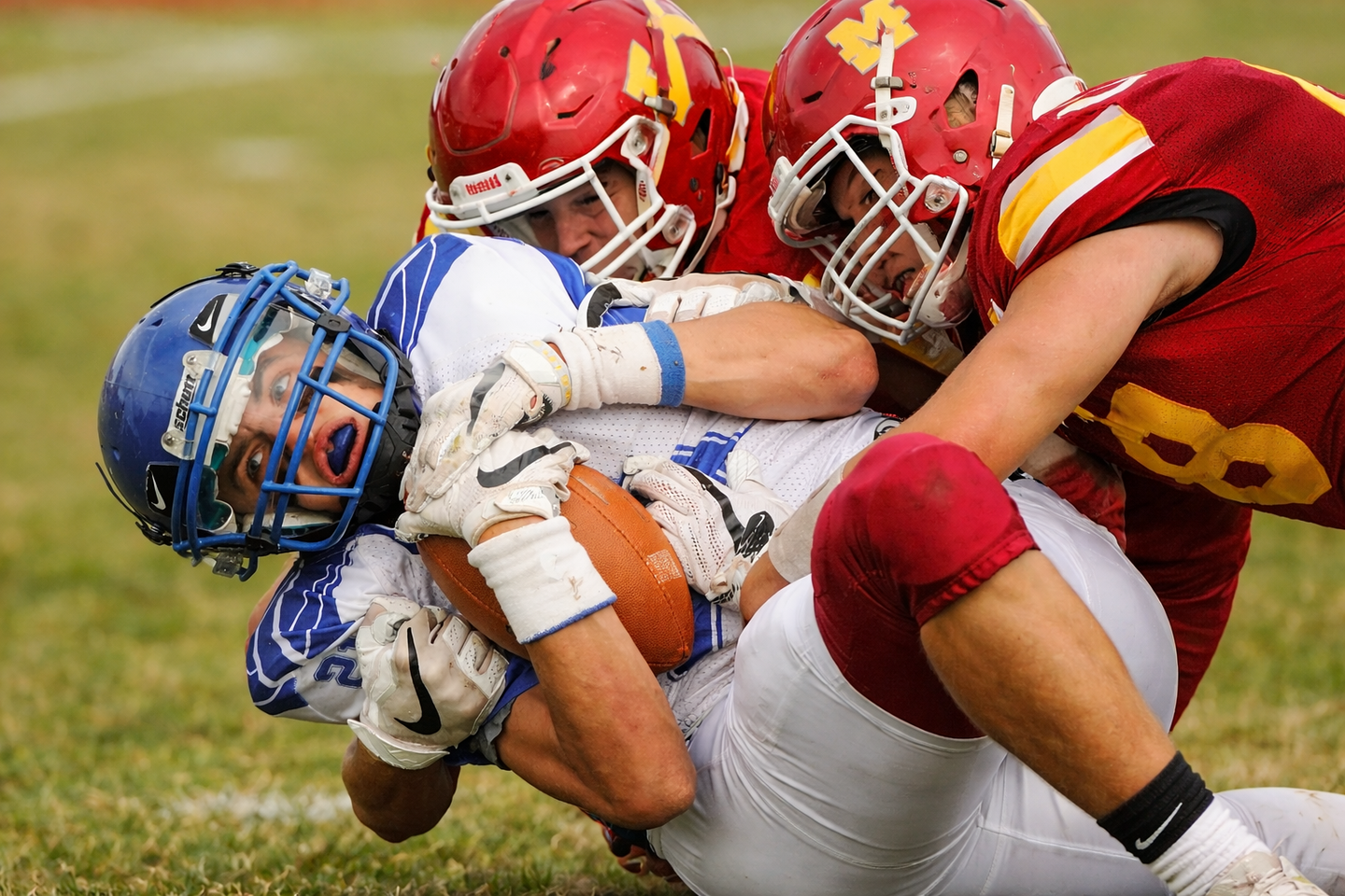 Studies link early single-sport training to higher injury rates and hip problems later, even among elite NFL athletes.