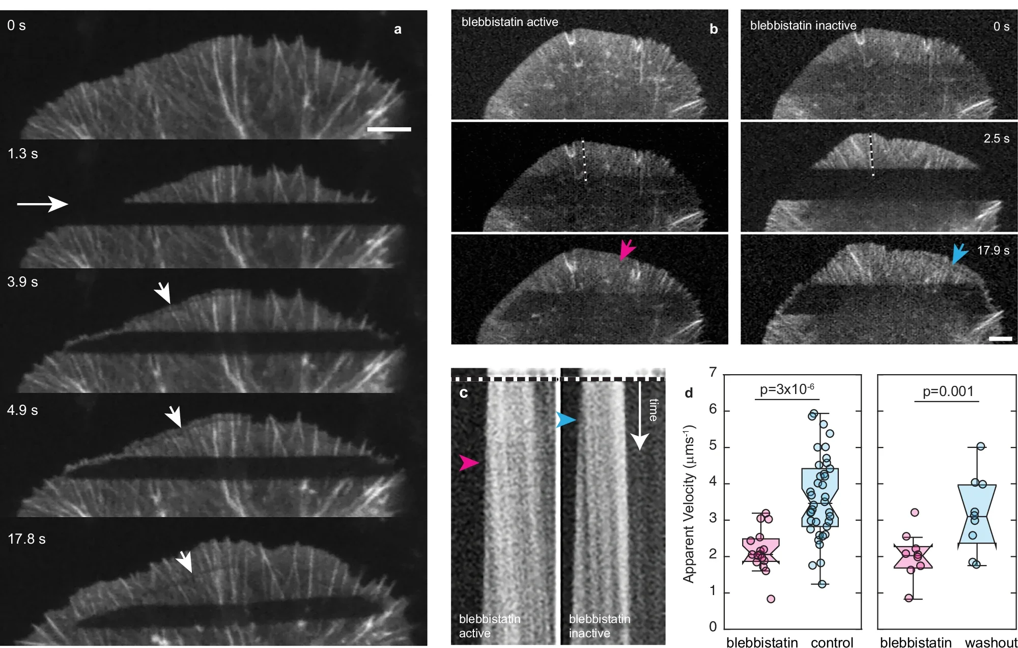 Transport of depolymerized actin to the polymerizing front is facilitated by myosin contraction.