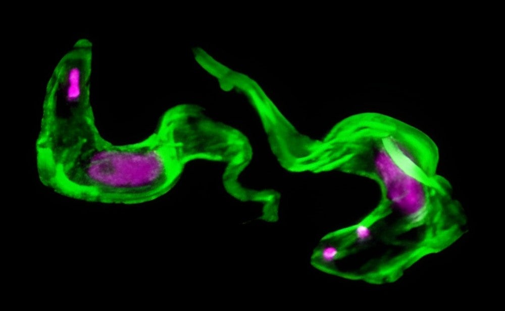 The DNA of the the African trypanosome parasite in magenta and it's protective "cloak" in green. 