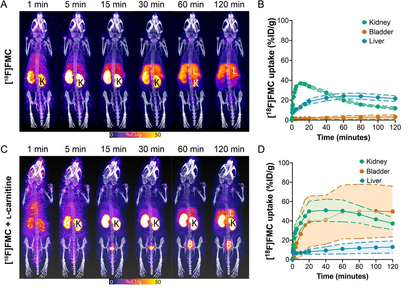 Imaging carnitine utilisation in vivo with [18F]FMC PET.