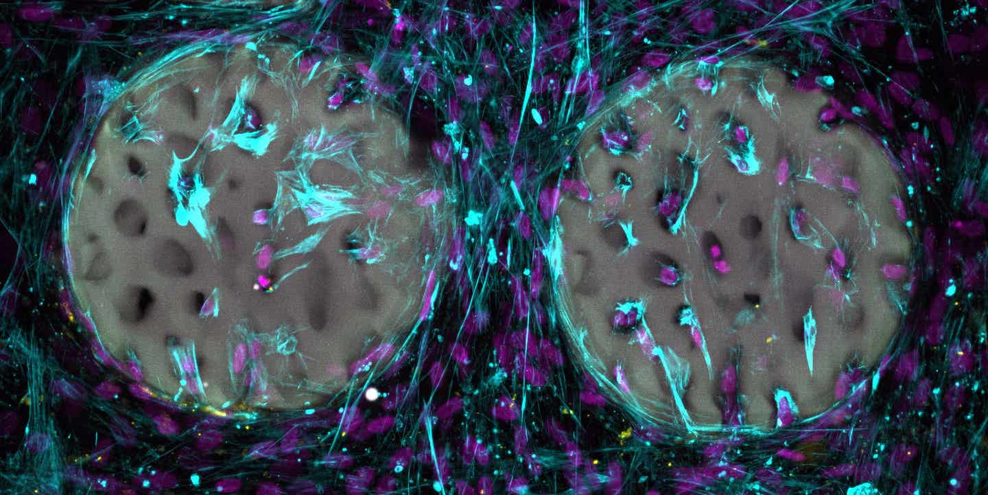 A good sign: Bone-forming cells (light blue) with nuclei (purple) have already colonized a hydrogel that has been structured like bone.