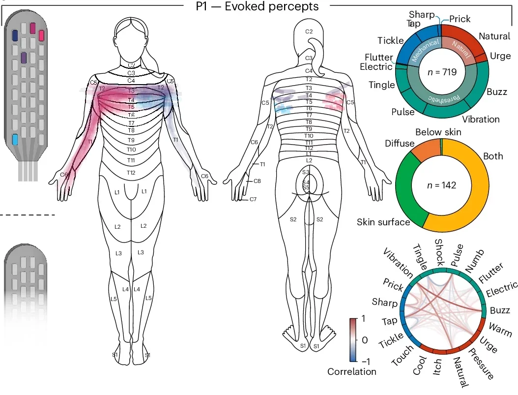 Supralesional EES evokes quantitatively and qualitatively diverse percepts.