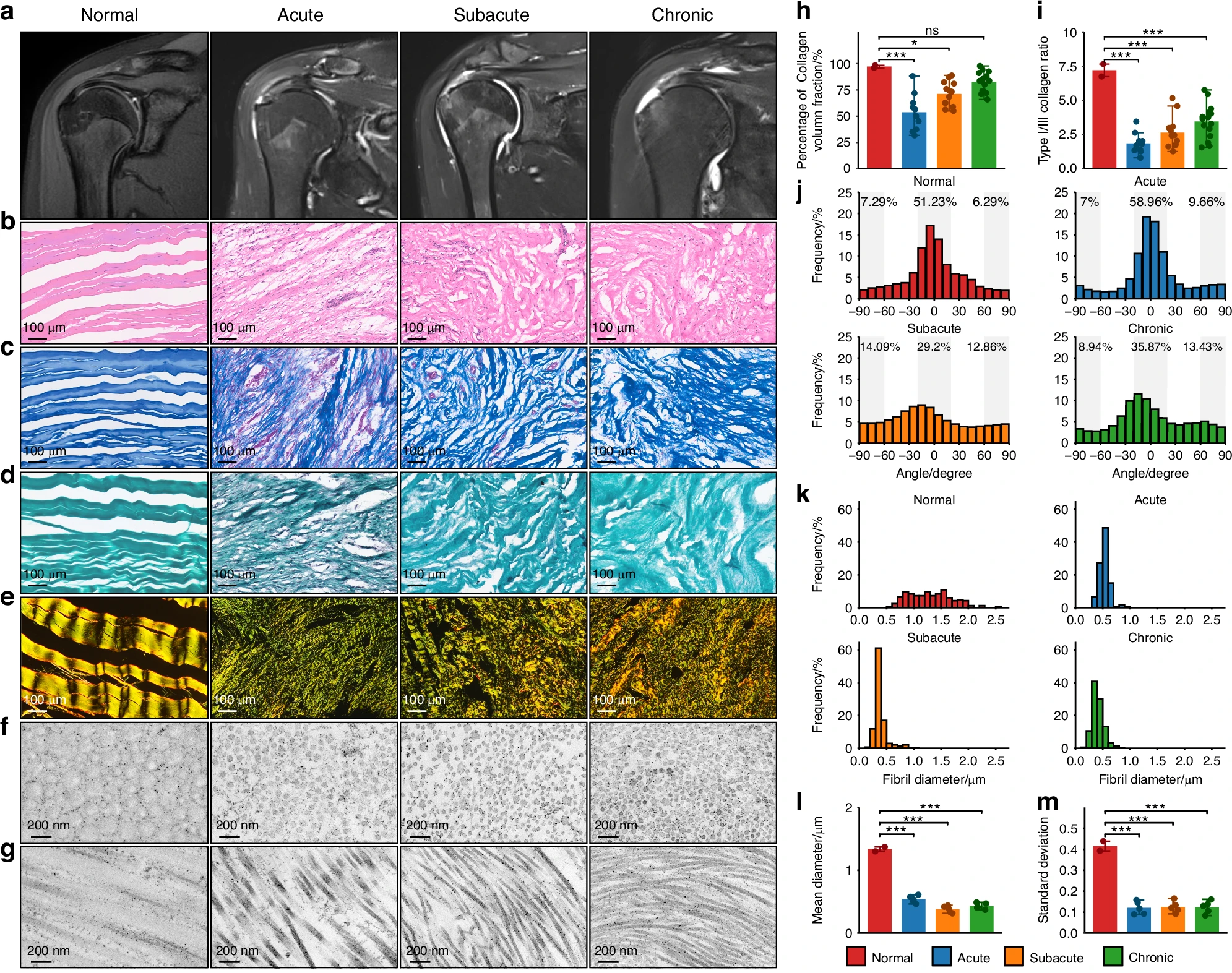 Scar formation after human rotator cuff injury. a MRI imaging of normal and different stages (acute, subacute, and chronic) of human RCT.