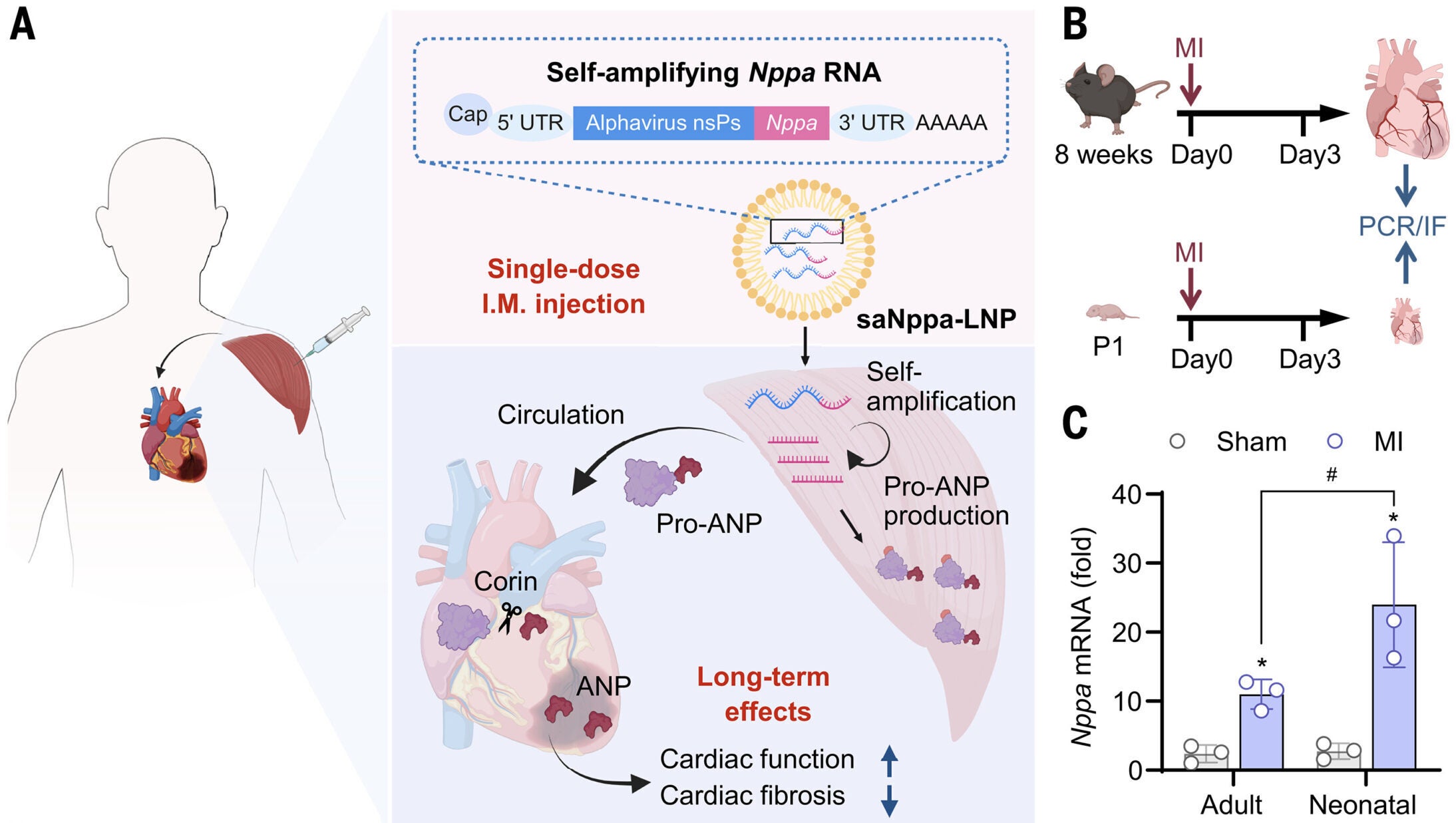Cardioprotective factor pro-ANP expression was insufficient in adult hearts after MI.