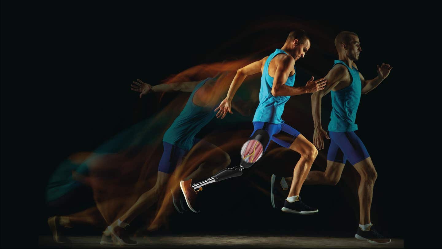 Decoding motor intentions directly from within peripheral nerves may enable more natural and intuitive control of prosthetic limbs.