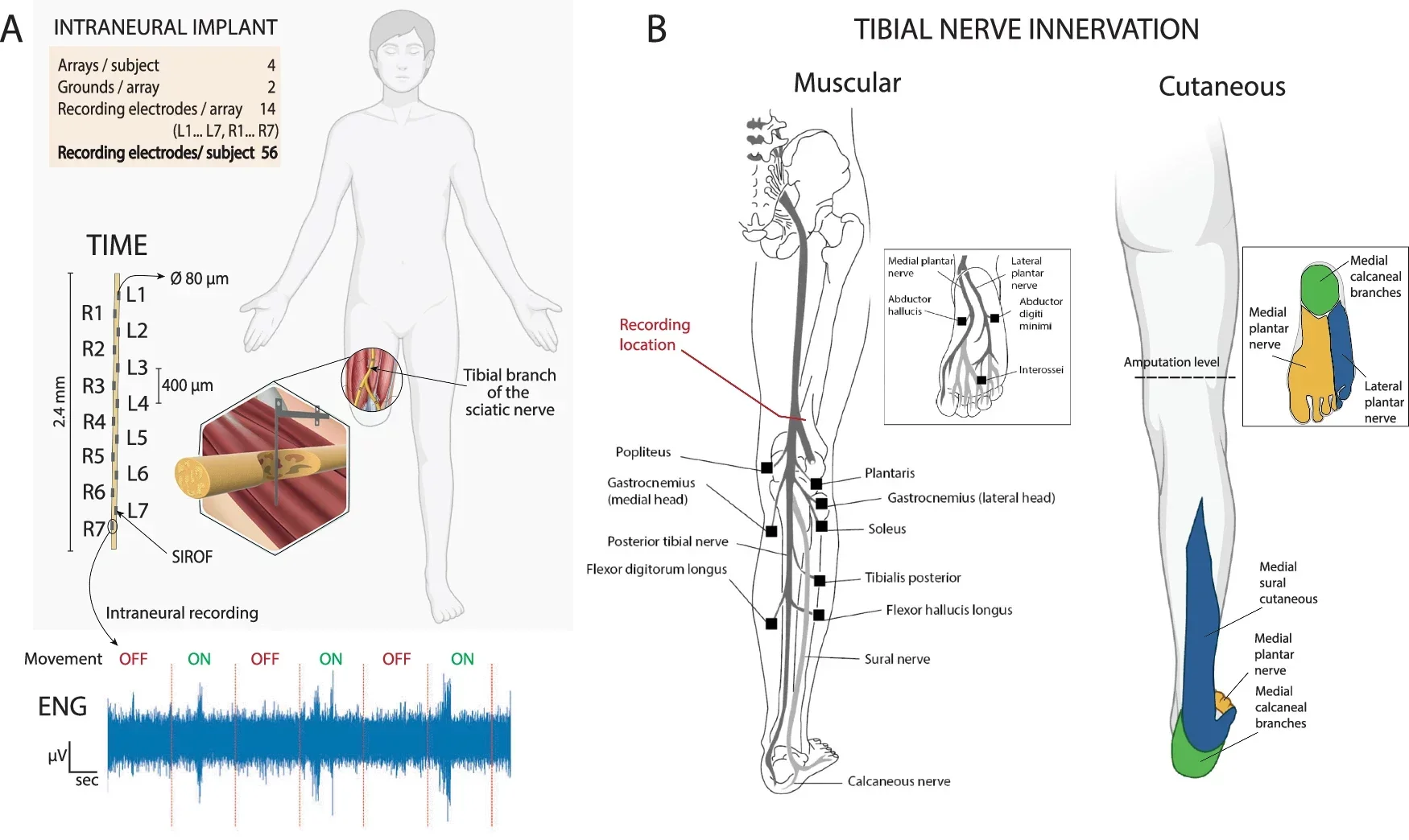 Intraneural recording of the tibial nerve during phantom movements.