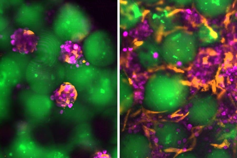 The microspheres (green), hepatocytes (magenta), and supporting fibroblasts (orange) assemble and reorganize into engineered liver grafts over time. Image shows a comparison of day zero (left) and day fourteen (right) of the grafts cultured in the laboratory.