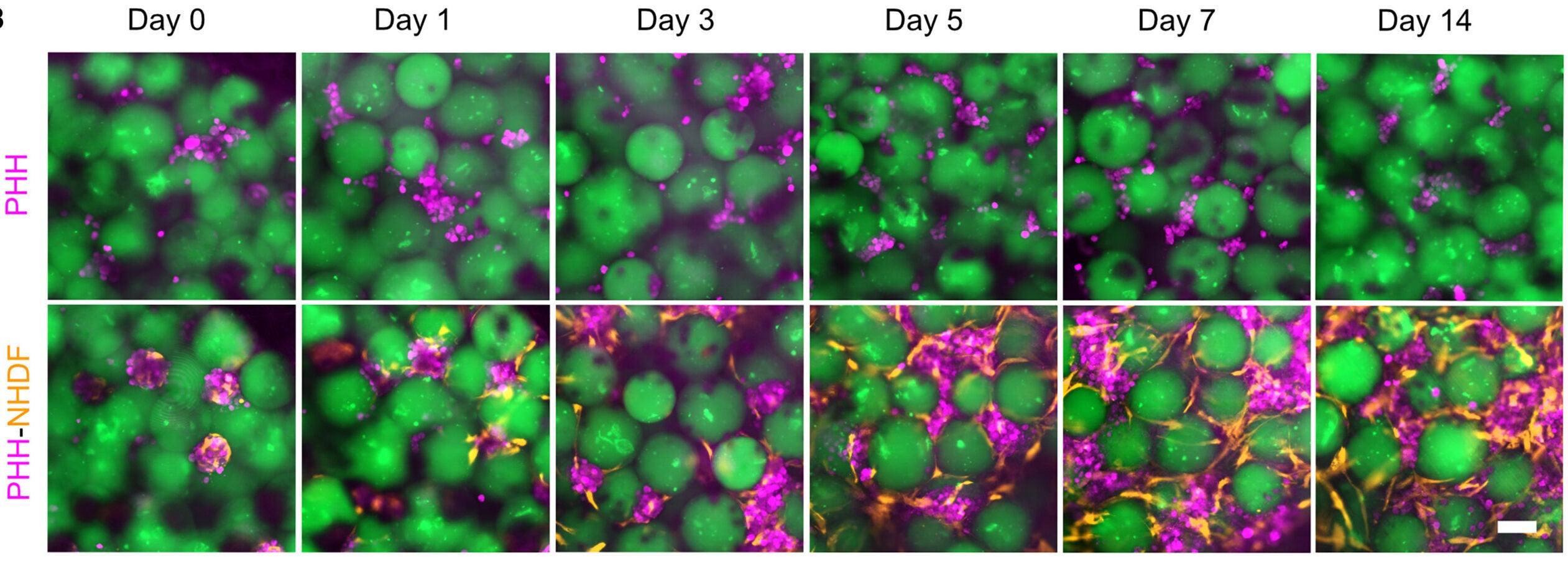 Longitudinal fluorescence imaging of PHH-only and PHH-NHDF aggregates among microspheres over the course of 14 days (scale bar, 100 μm).