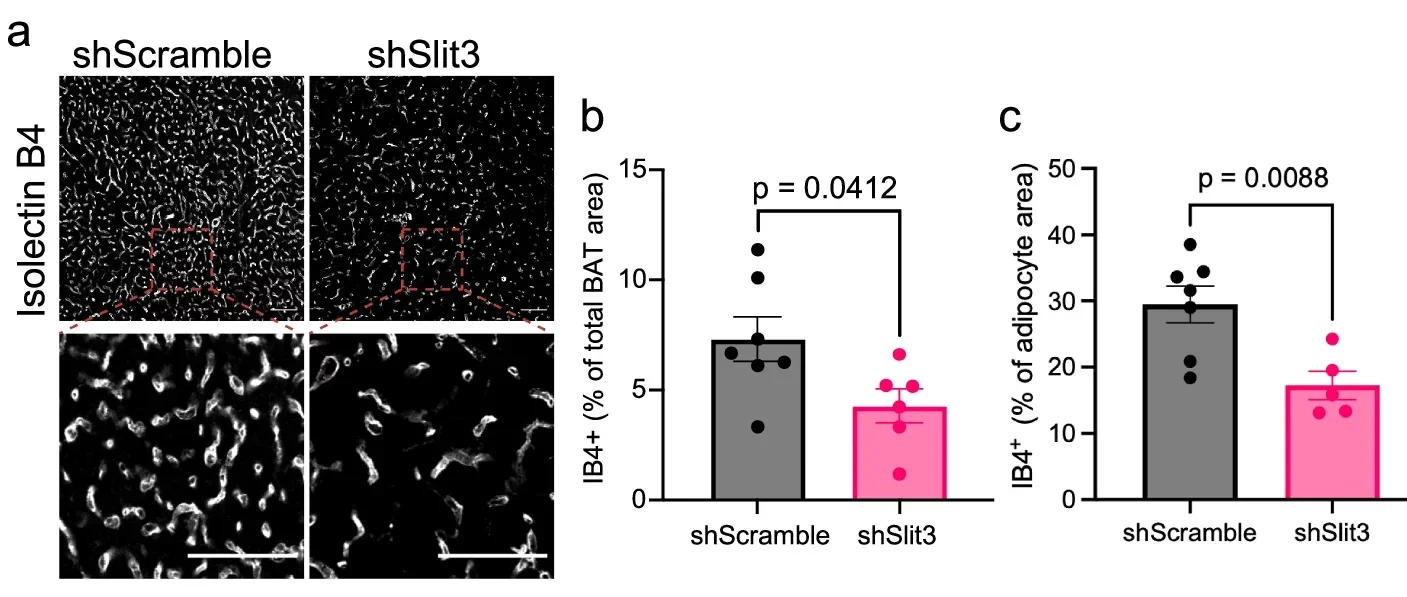 Loss of Slit3 impairs cold-induced angiogenesis and sympathetic innervation in BAT.