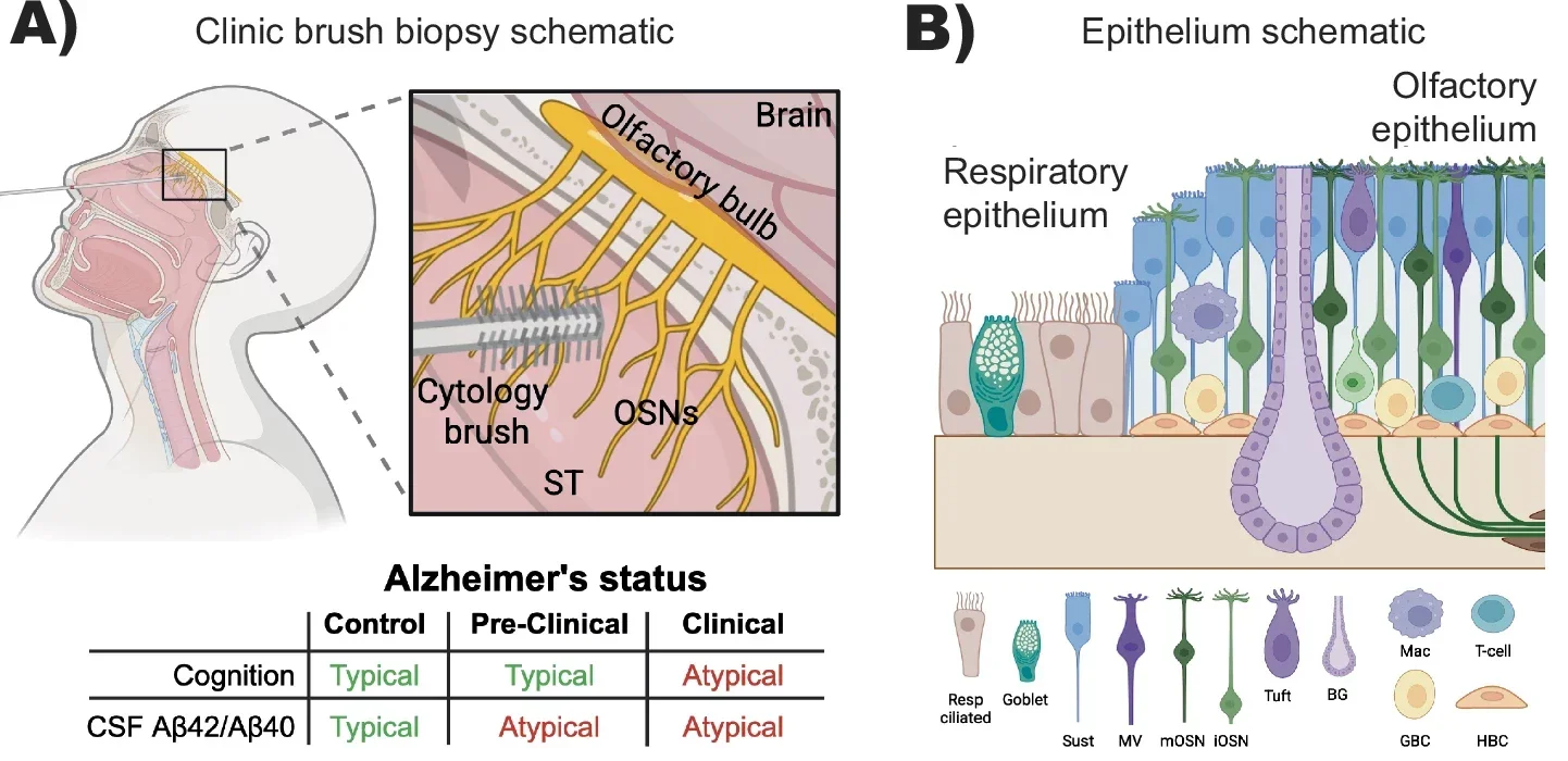Brush biopsies as a practical strategy for sampling olfactory epithelium in Alzheimer’s Disease.