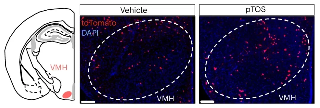 Anatomical location (left) and representative immunofluorescence section (right) of pTOS-activated neurons in the VMH in 10-week-old male mice after treatment with vehicle or pTOS.