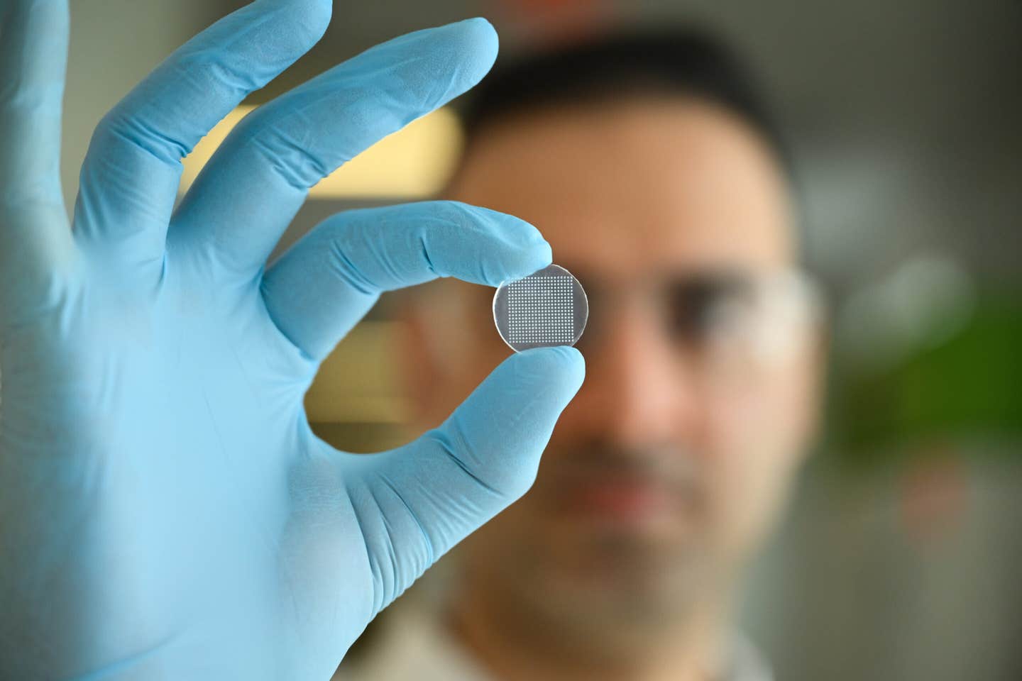 Sasan Jalili holds the microneedle skin patch, which is about the size of a quarter.