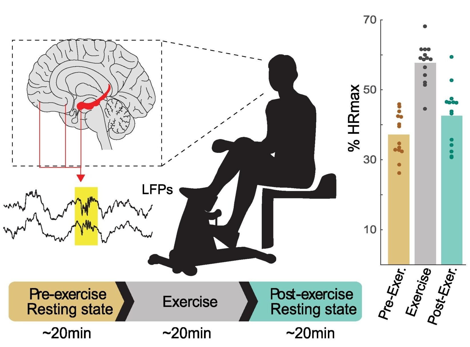 Paradigm, electrode coverage and ripple detection.