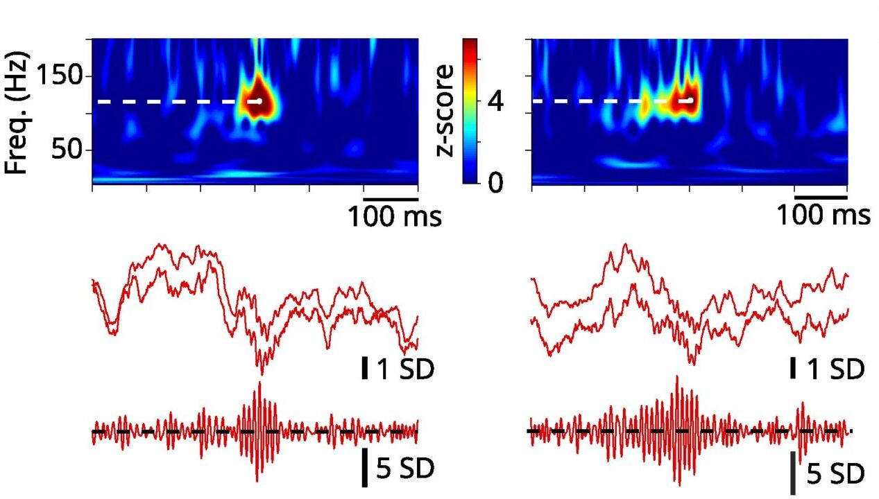 Effect of acute exercise on ripple properties.