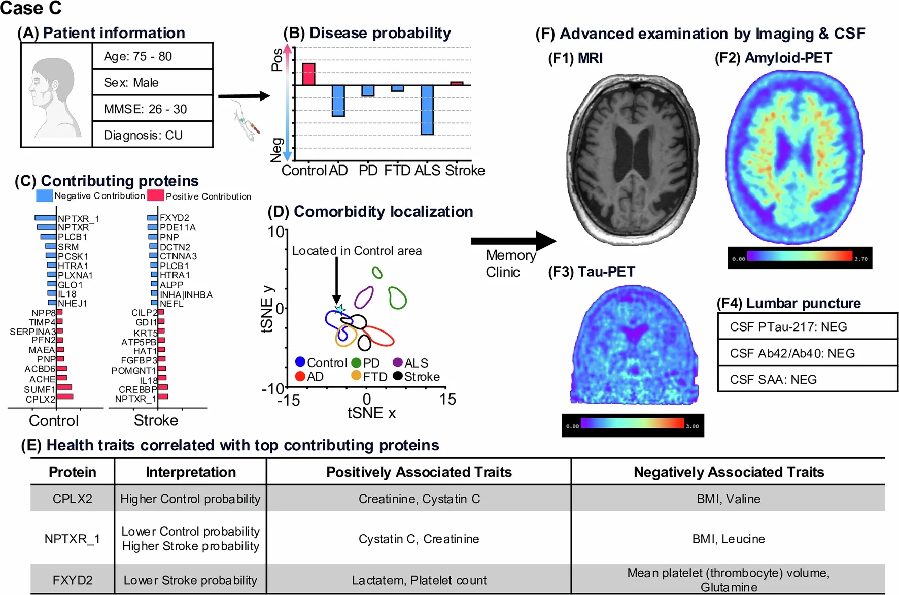 Individual neurodegeneration risk report (Case C).