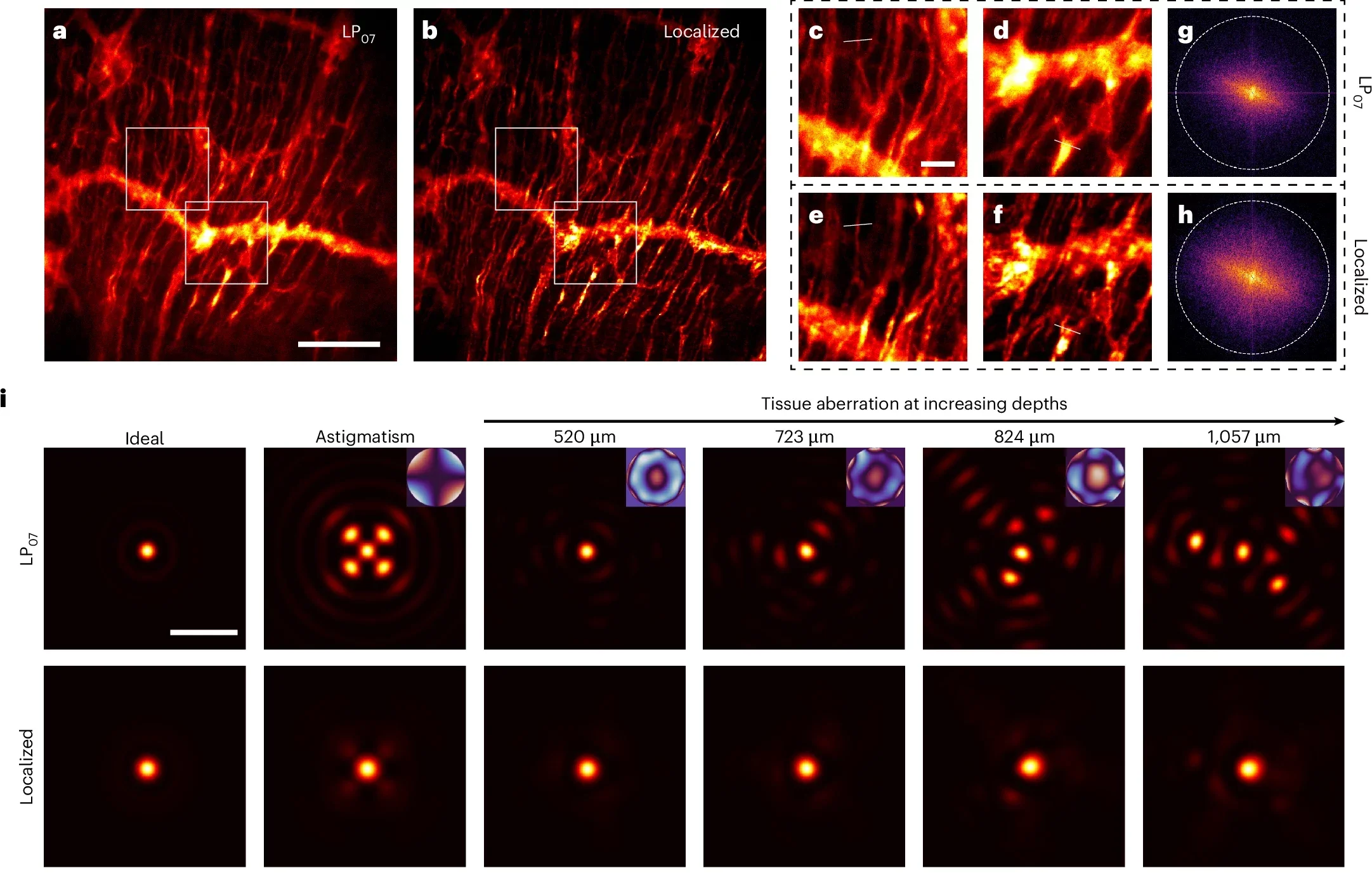 Volumetric imaging comparison of the single near-Bessel LP0n beam and the localized beam.