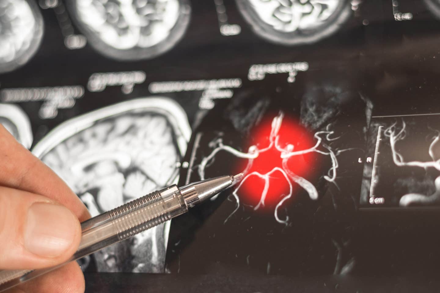 New research finds lifelong cognitive stimulation can protect brain function and memory in Alzheimer’s models, revealing key sex differences.