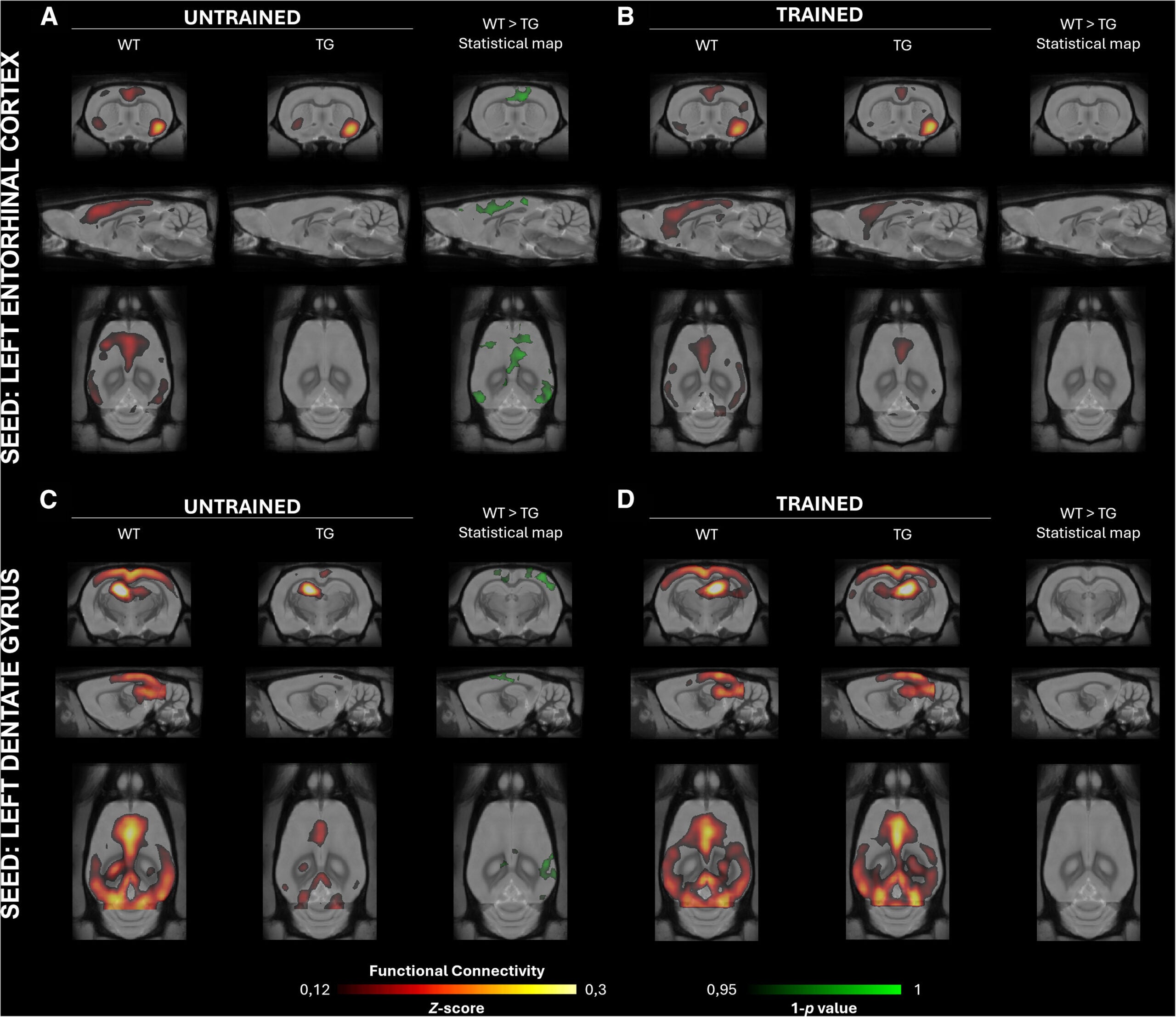 Seed-based analyses of the EC and DG reveal restored functional connectivity in trained TG rats