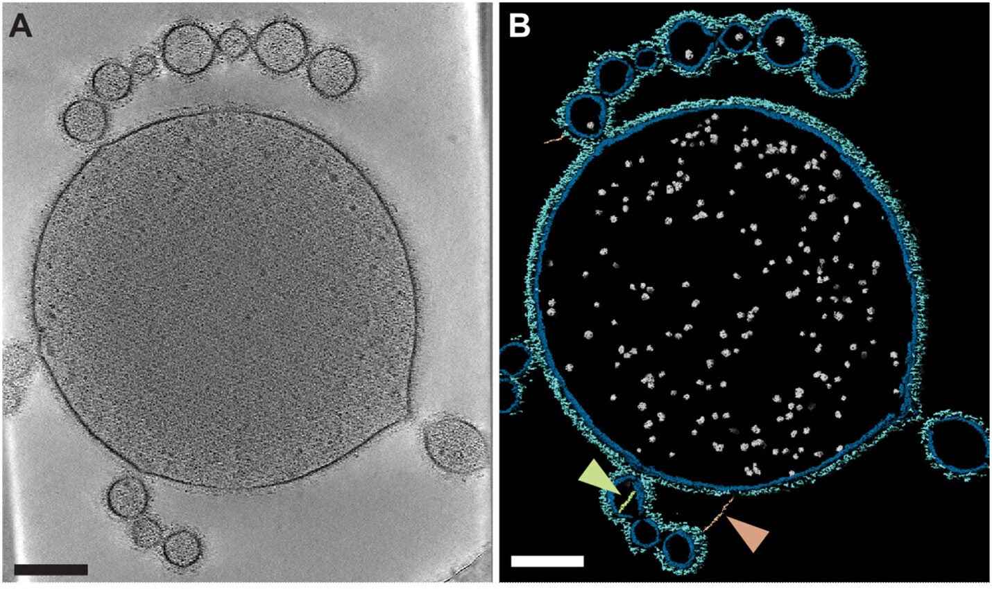 Structural features of Nerearchaeum marumarumayae cells