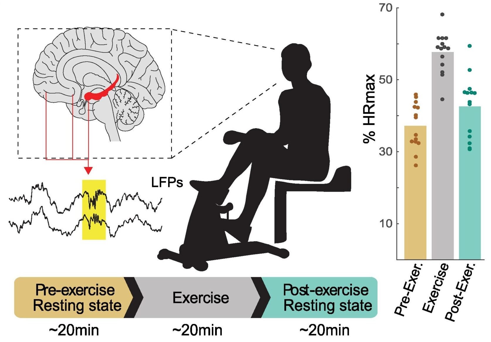 Illustration of the experimental paradigm. Neurosurgical patients (a total of 14 included) were instructed to complete an acute exercise paradigm while intracranial EEG activity was continuously recorded.