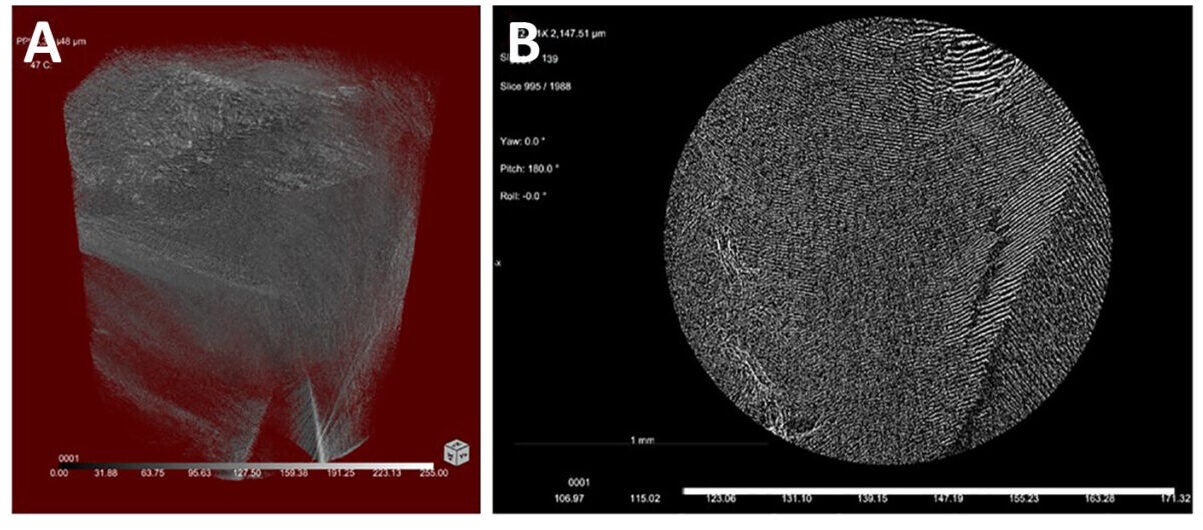 Micro-CT analysis of clots formed in adult plasma: (A) 3D reconstruction and (B) 2D cross-sectional view of the fibrin network structure.